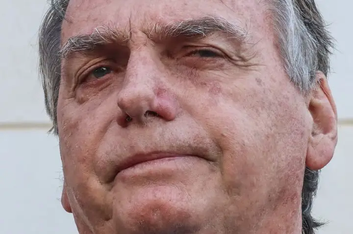 Bolsonaro apresenta piora clínica e vai passar por novos exames