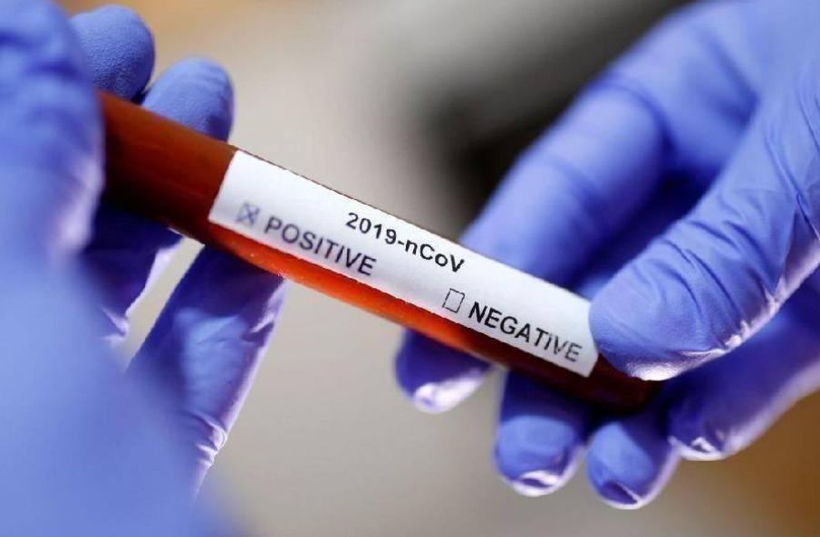 6,441 vacinas foram aplicadas nesta sexta, 14