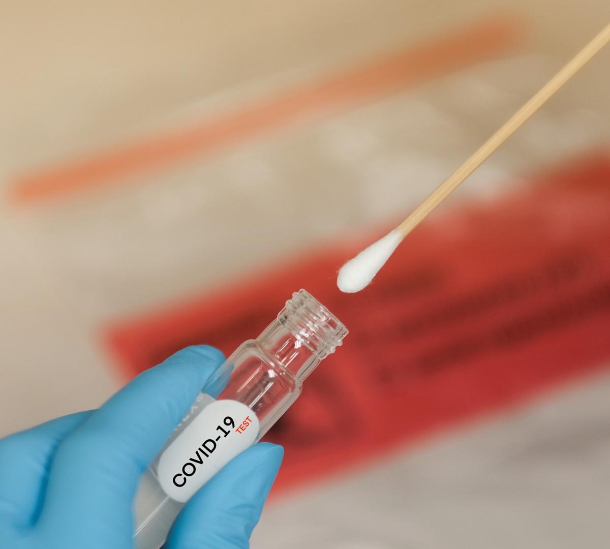 Dados epidemiológicos desta quarta-feira, 20