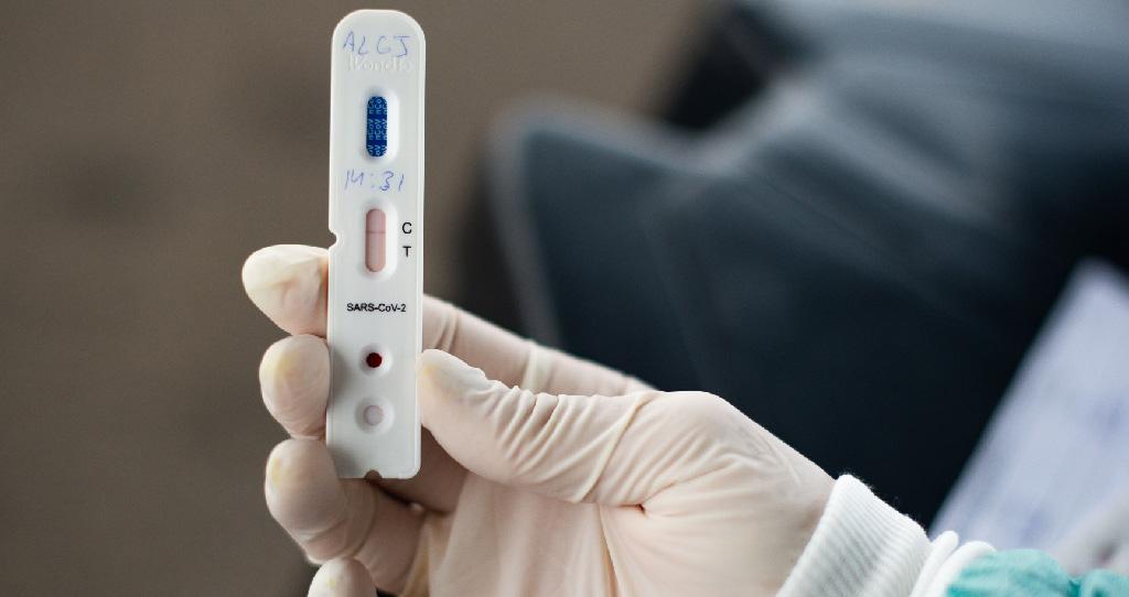 Dados epidemiológicos desta sexta-feira, dia 5