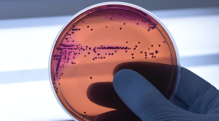 Entenda o que são superbactérias e a ameaça global da resistência a antibióticos