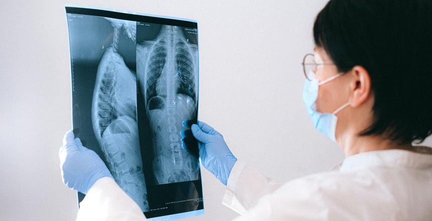 Secretaria de Saúde realiza evento sobre tuberculose para servidores