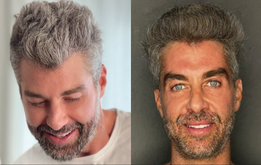 O modelo Ricardo Braga também aderiu à Loção Gradual Color. Diferença com 60 dias de uso