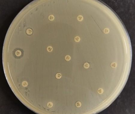 Bactéria Multirresistente: A Ameaça Global que Cresce Após a Pandemia e Chega ao Brasil
