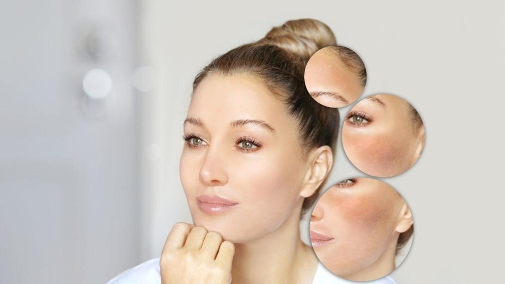 O que é Melasma? Entenda as Causas, Tipos e Tratamentos   O melasma é uma condição dermatológica bastante comum, caracterizada por manchas escuras na pele, principalmente no rosto.