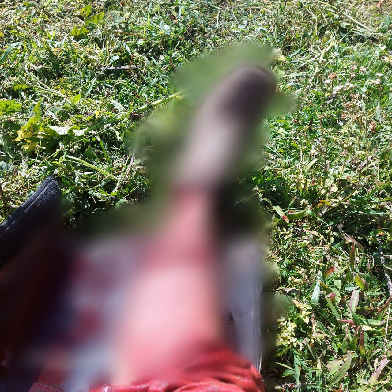 Homem sofre fratura na perna em acidente com roçadeira em São Brás do Suaçuí