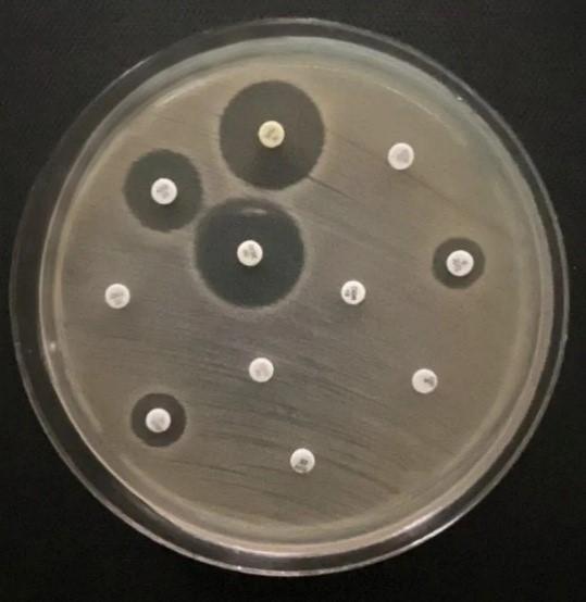 Bactérias detectadas em rio urbano, cão doméstico e lesões de pele ressaltam risco da multirresistência microbiana