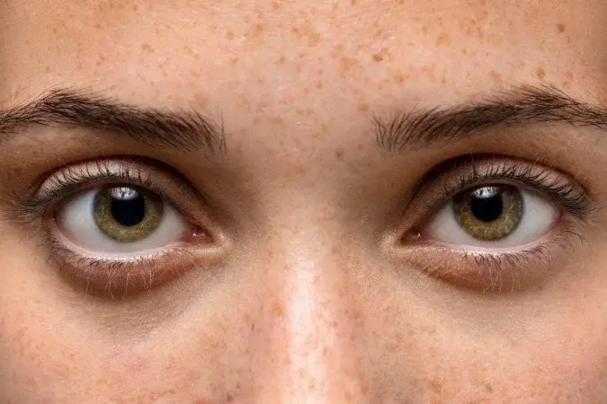 Alterações nos olhos podem indicar problemas de saúde; veja sinais de alerta