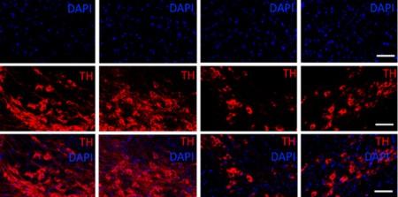 Molécula anti-inflamatória mostra potencial contra Parkinson em estudo com camundongos