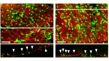 Perda de microbiota altera o perfil das células que protegem a parede do intestino
