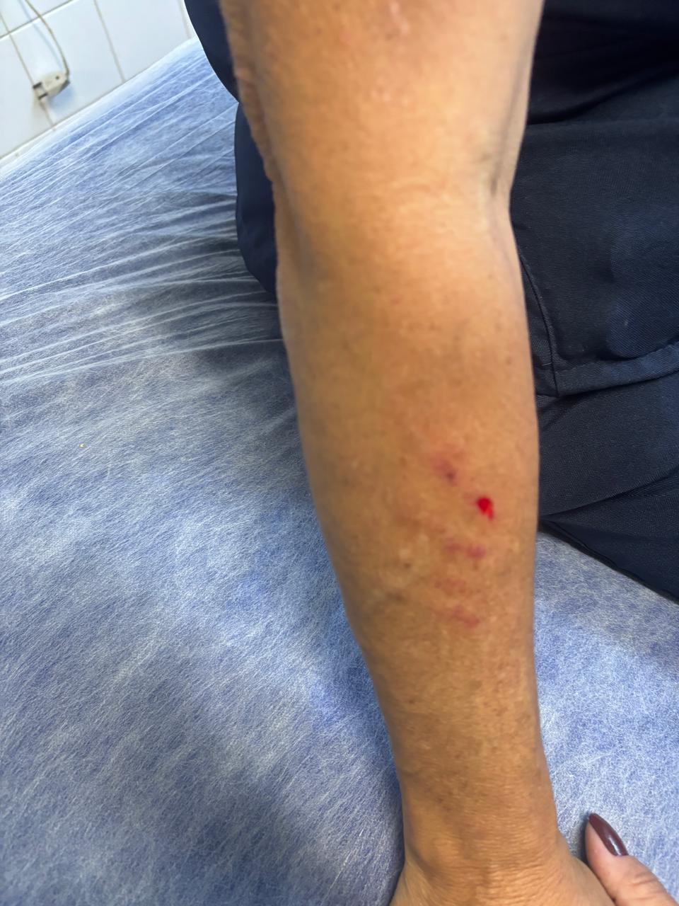 Servidores da saúde protestam por segurança após série de agressões em Juiz de Fora