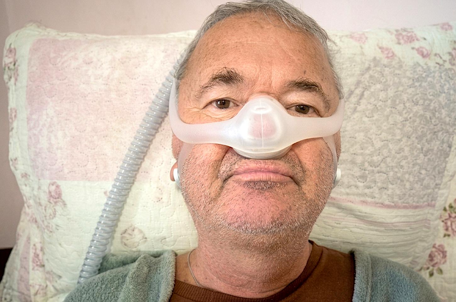 UNIMED nega assistência vital a paciente com ELA