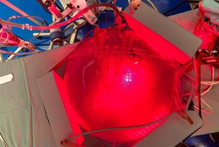 ‘Gêmeo digital’ do tórax simula aplicação de luz para tratamento de pneumonias
