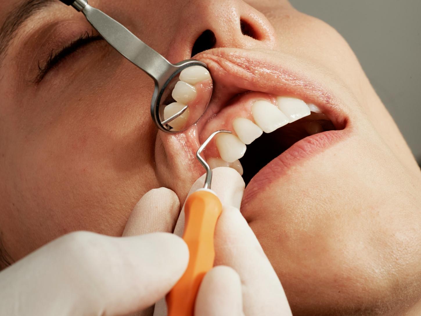 O valor de um dente fixo: implantes dentários e sua evolução