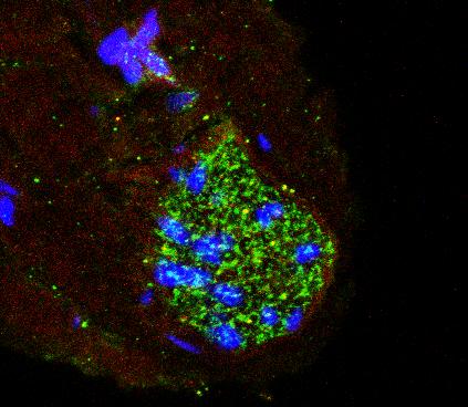Estrutura que controla a pressão arterial também age como ‘radar’ de inflamação
