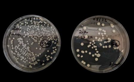 Estudo investiga associação de clorexidina e fitoterápicos contra fungo causador de infecção hospitalar