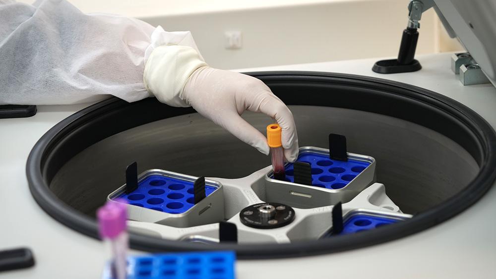 Marcadores no sangue podem prever eficácia de imunoterapia contra melanoma avançado