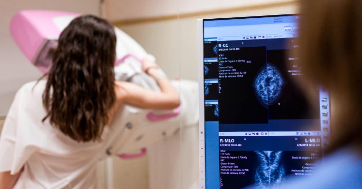 MGApp ganha função para acompanhar mamografias em Minas Gerais