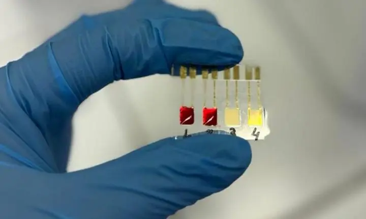 Biossensor identifica câncer de pâncreas em estágios iniciais