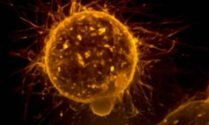Cientistas descobrem possível forma de desativar mecanismo de progressão do câncer