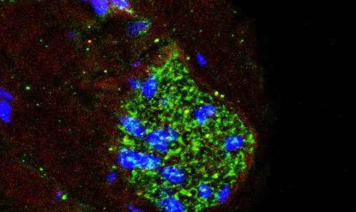 Estrutura que controla a pressão arterial também age como ‘radar’ de inflamação