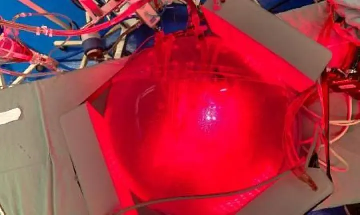 ‘Gêmeo digital’ do tórax simula aplicação de luz para tratamento de pneumonias