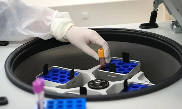 Marcadores no sangue podem prever eficácia de imunoterapia contra melanoma avançado