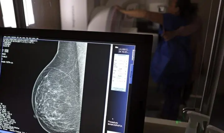 Médicos publicam guia para evitar recusa de mamografia digital