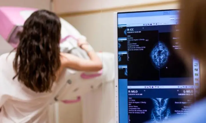 MGApp ganha função para acompanhar mamografias em Minas Gerais