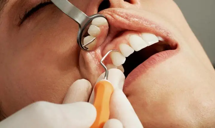 O valor de um dente fixo: implantes dentários e sua evolução