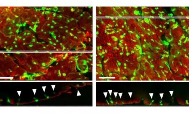 Perda de microbiota altera o perfil das células que protegem a parede do intestino