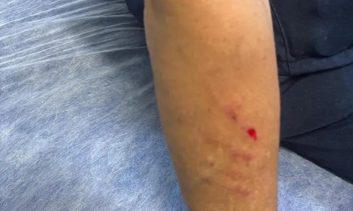 Servidores da saúde protestam por segurança após série de agressões em Juiz de Fora